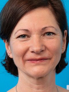 Беттина Риклефс