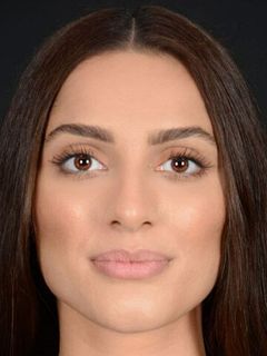 Nuray Hüseynova