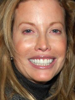 Диандра Дуглас