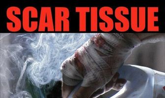 Scar Tissue