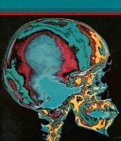 The Ultimate Impostor