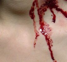 Blood + Roses