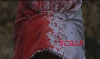 Scalp