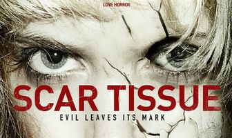 Рубцовая ткань