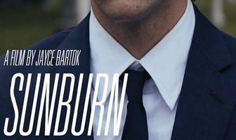 Sunburn