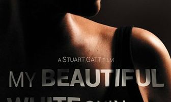 My Beautiful White Skin