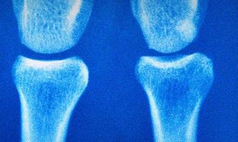 Поставьте мне диагноз